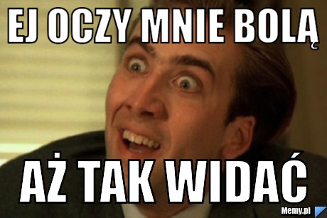 Ej oczy mnie bolą aż tak widać