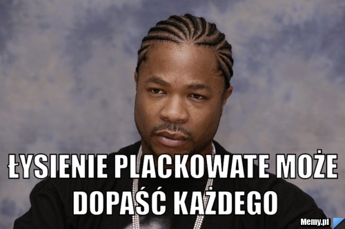  łysienie plackowate może dopaść każdego