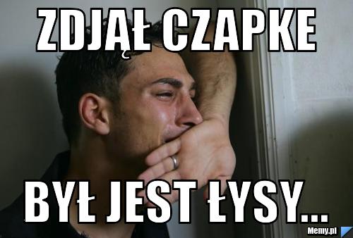 Zdjął Czapke Był Jest łysy...